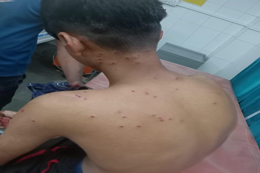 Two Youths Injured by BSF Gunfire Dur...